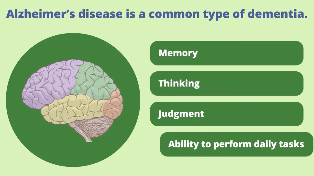 Illustrated brain beside labels for memory thinking judgment and ability to perform daily tasks